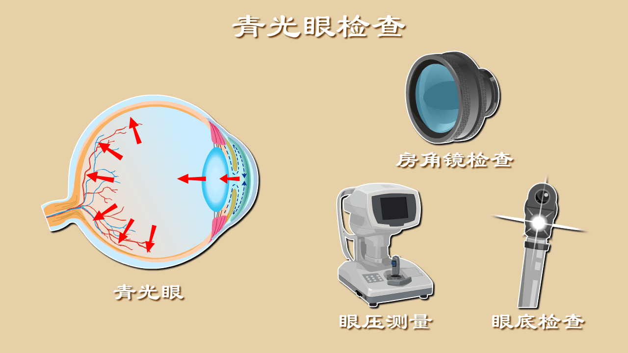 青光眼的最新消息，研究、治療與預(yù)防的新進展，青光眼研究、治療與預(yù)防的最新進展報道速遞