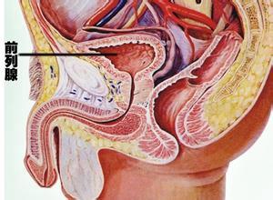 慢性前列腺炎的癥狀及其影響，慢性前列腺炎的癥狀及影響概述